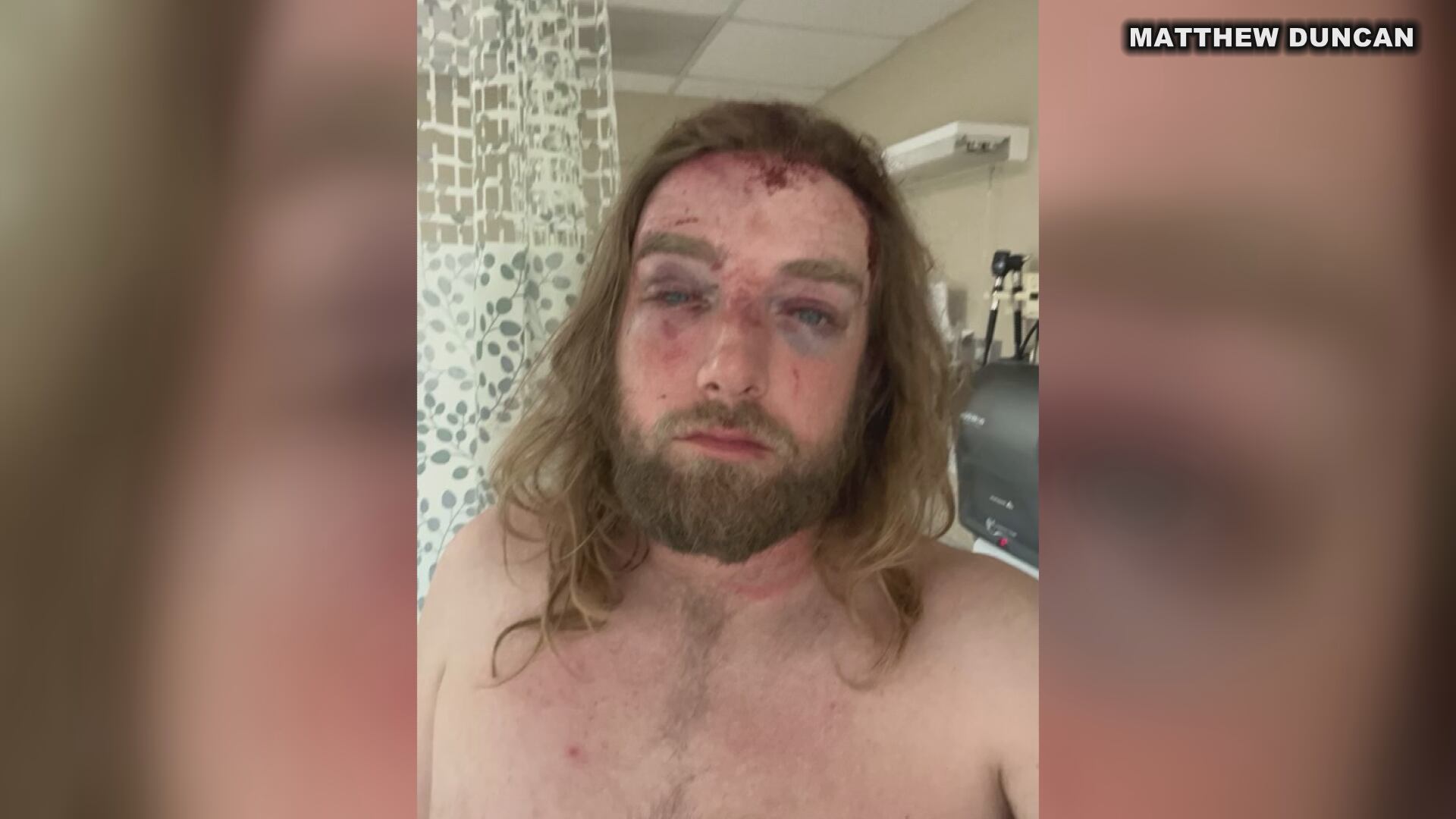 Warrant: Former sheriff's sergeant pinned victim against car with truck; victim speaks out - Vimarsana News